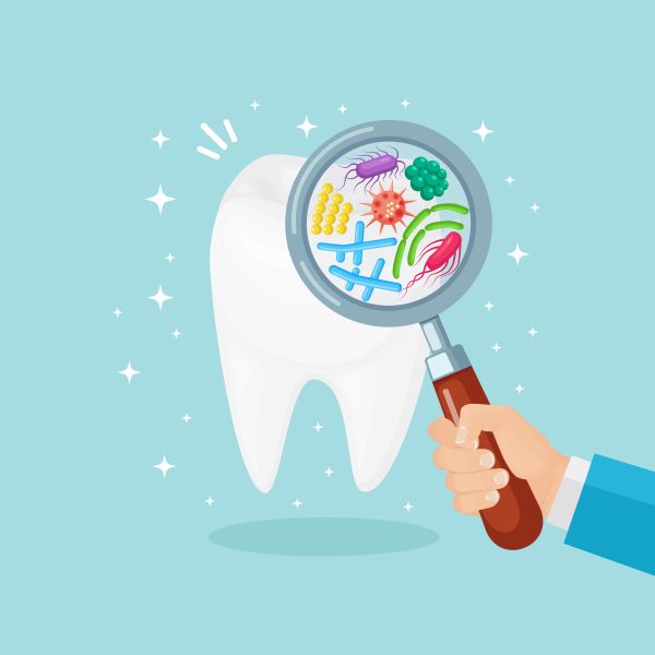 How Is Tooth Decay Diagnosed at Your Dental Checkup?