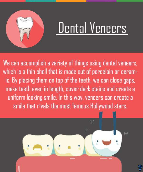 Dental Veneers and Dental Laminates Tempe, AZ